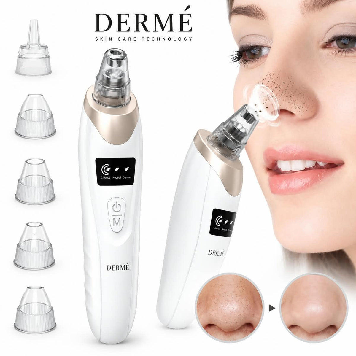 DERME Suction Facial Cleanser | Electric Blackhead Remover – White & Gold ✨