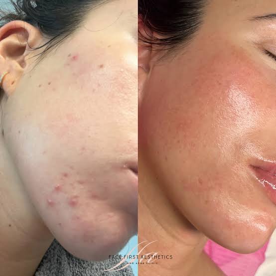 Customer photo